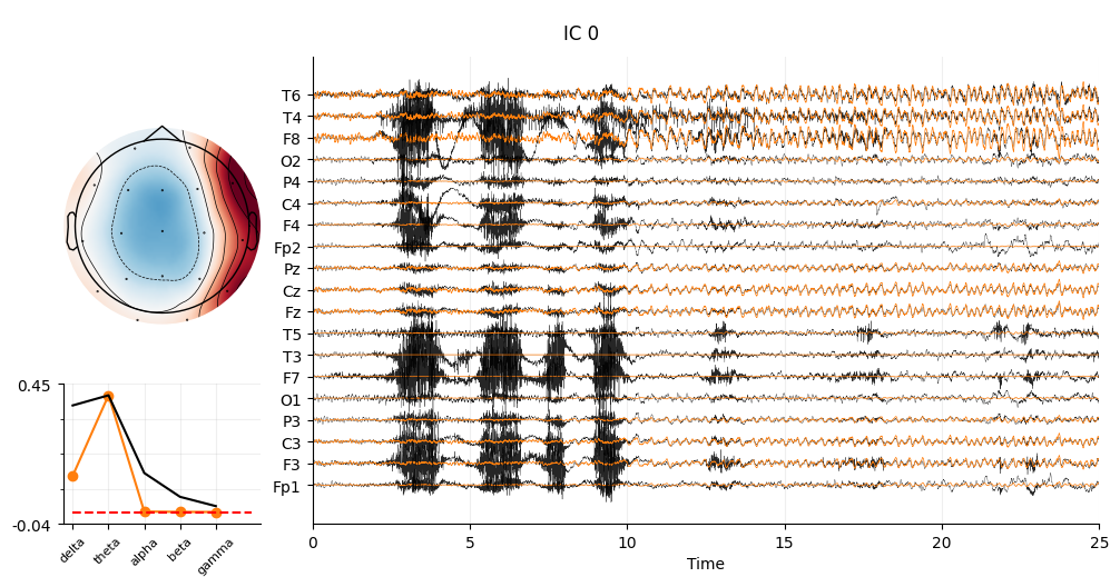 EEG saliency maps.